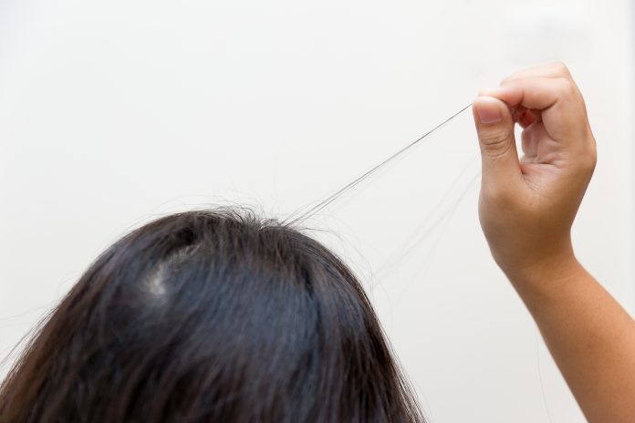 Hair pulling disorder or Trichotillomania in teenager women mental health problem.