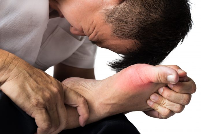 Um homem que sofre de gota dolorosa e inflamada no pé direito ao redor da área do dedo grande do pé.