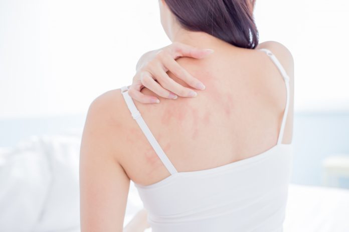 mulher coçando seu ombro e pescoço por causa da pele seca em casa