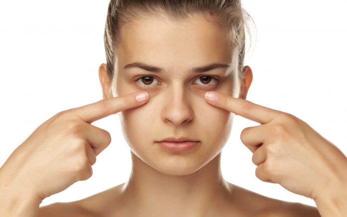 Young woman touching her low eyelids on white background