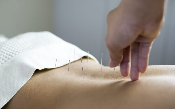 trattamento di agopuntura tradizionale
